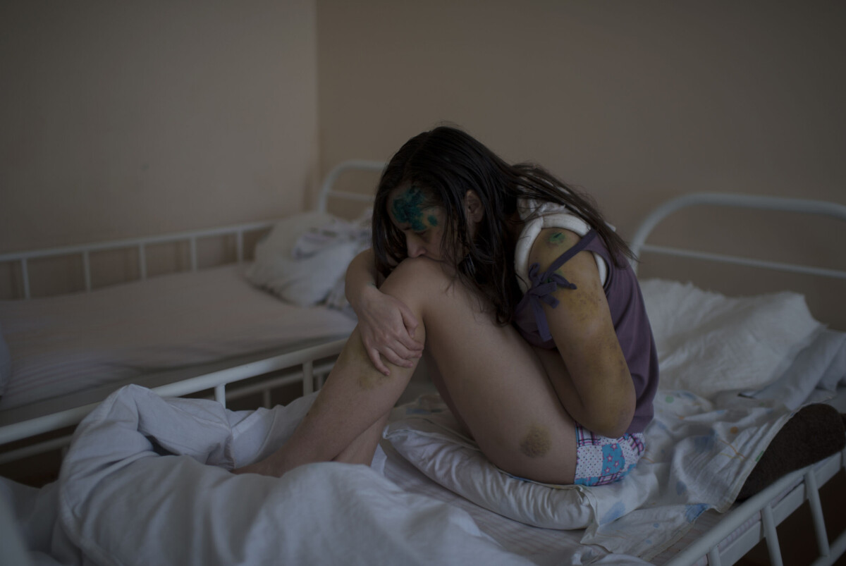 Syrien. Kaleria Berzovskaya, 13, var evakuerad men längtade till mamma och pappa. När hon återvände hem blev
lägenheten träffad av en raket. Delar av taket föll över henne och nu får hon vård på det regionala barnsjukhuset i Done.