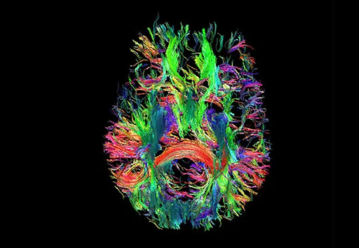 È stata catturata un'immagine del cervello umano con una risoluzione fino a 10 volte superiore. È stata catturata un'immagine del cervello umano con una risoluzione fino a 10 volte superiore.